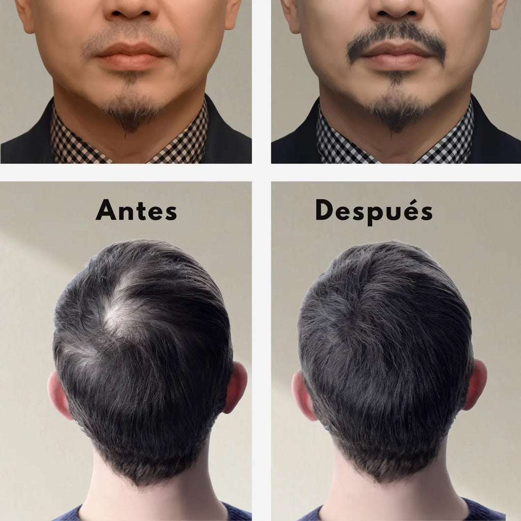 Balsamo Capilar Minoxidil al 4%; 30ml, Azabache.